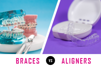 Pineville dentist, Dr. Gauthier at Today's Dental, talks about what factors need to be considered when deciding between getting braces or clear aligners for corrections.