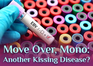 Pineville dentist, Dr. Jonas Gauthier at Today's Dental talks about a kissing disease you might be less familiar with than mononucleosis.