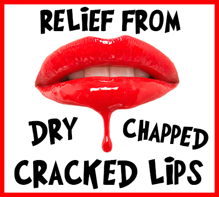 Pineville dentist, Dr. Jonas Gauthier at Today's Dental, tells you how to relieve your dry, chapped, and cracked lips!
