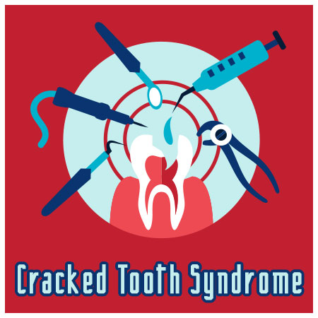 Pineville dentist, Dr. Jonas Gauthier at Today’s Dental, discusses causes, symptoms, and treatment of cracked tooth syndrome.