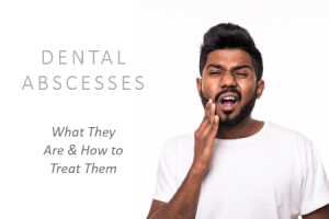 Pineville dentist, Dr. Gauthier at Today's Dental, explains what dental abscesses are and what action you can take to prevent them.