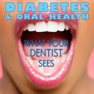 Pineville dentist, Dr. Jonas Gauthier of Today's Dental, discusses the side effects of diabetes and how it affects your oral health.
