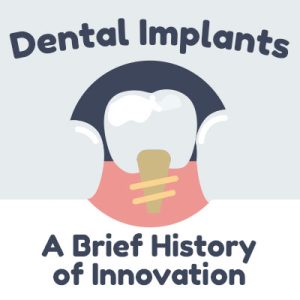 Pineville dentist, Dr. Jonas Gauthier of Today's Dental Pineville discusses dental implants and shares some information about their history.