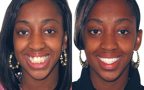 Kayla Before and After