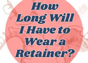 Pineville dentist Dr. Jonas Gauthier of Today's Dental Pineville discusses how long a retainer should be worn after orthodontic treatment