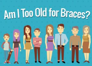 Pineville dentist, Dr. Jonas Gauthier of Today's Dental discusses braces and what age, if any, is too late to straighten teeth.