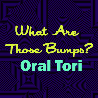 Pineville dentist, Dr. Jonas Gauthier at Today's Dental explains oral tori—what they are, why they happen, and whether they are a cause for concern.