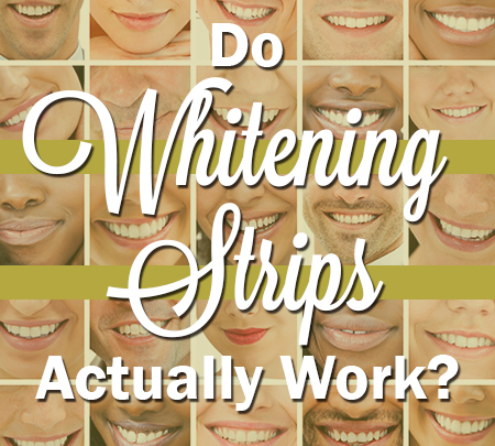 Pineville dentist, Dr. Jonas Gauthier, answers the frequently asked question, “Do whitening strips actually work?”