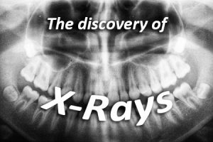 Pineville dentist, Dr. Jonas Gauthier at Today's Dental discusses the discovery of x-rays and how they have advanced over the years.