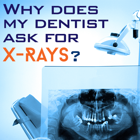 Why does my dentist ask for x-rays?