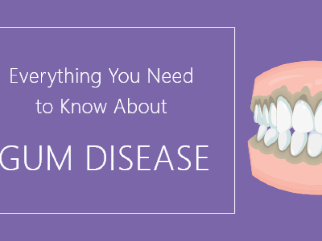 Everything You Need to Know About Gum Disease (featured image)