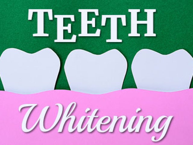 Types for all Stripes: Teeth Whitening (featured image)
