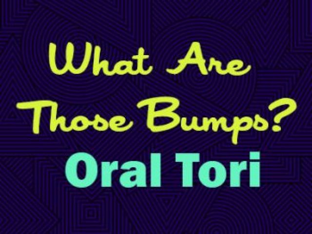What Are Those Bumps? Oral Tori (featured image)