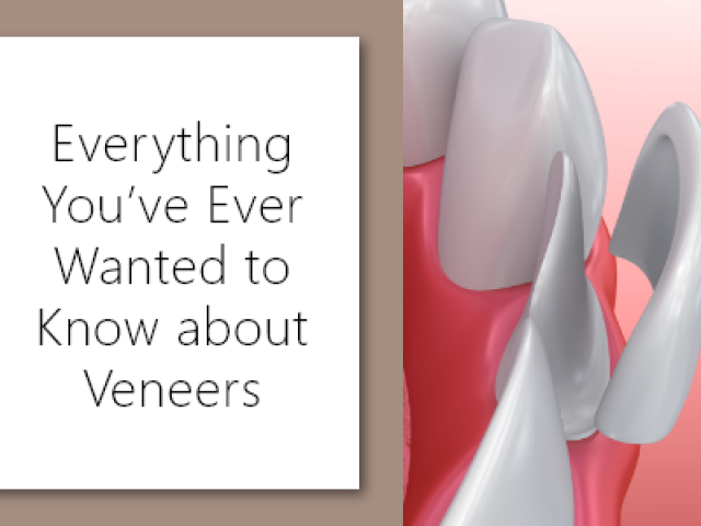 Everything You’ve Ever Wanted to Know about Veneers (featured image)